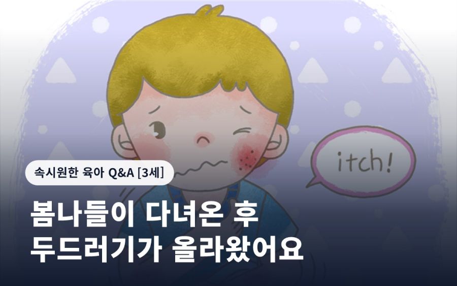 봄나들이 다녀온 후 두드러기가 올라왔어요